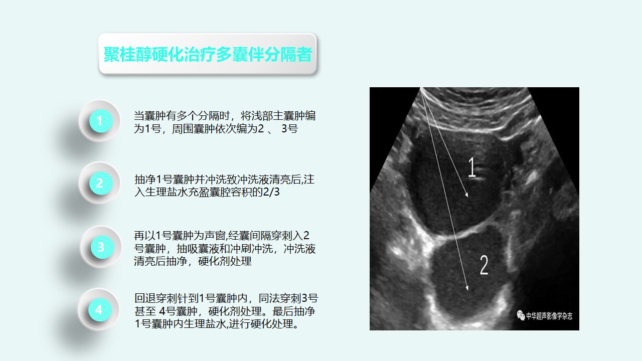 幻灯片32.jpg